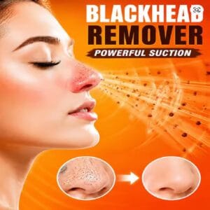Smart Electric Blackhead Remover Facial Cleaner